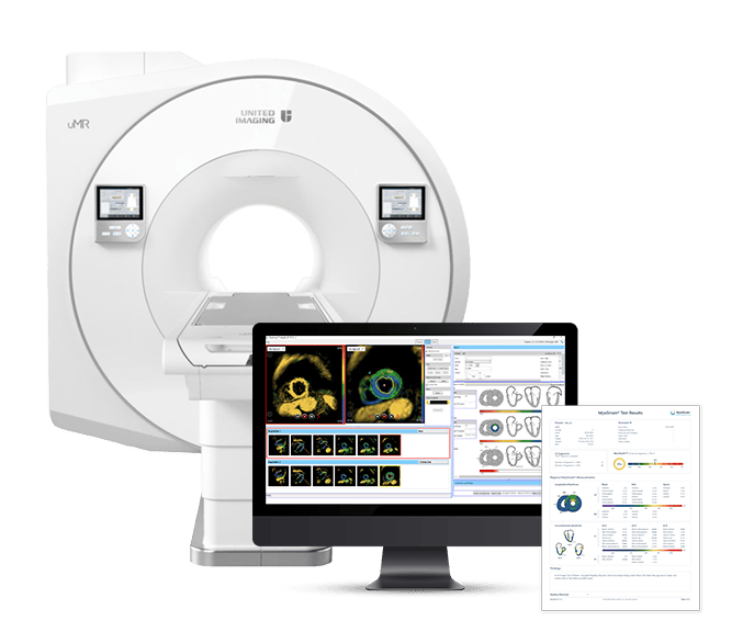 611278a3e9ea986c9937165b_myostrain mri-report 611278a3e9ea986c9937165b_myostrain mri-report