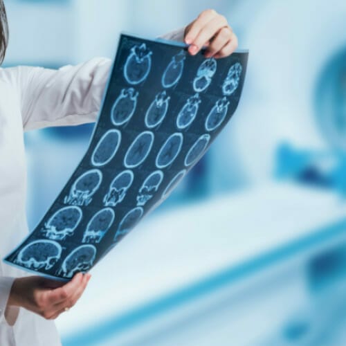 MRI mri-scan