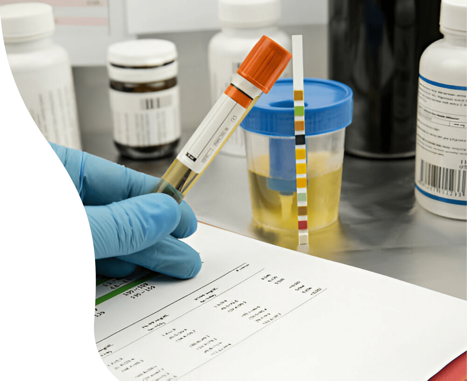 Urine tests hero Urine tests hero